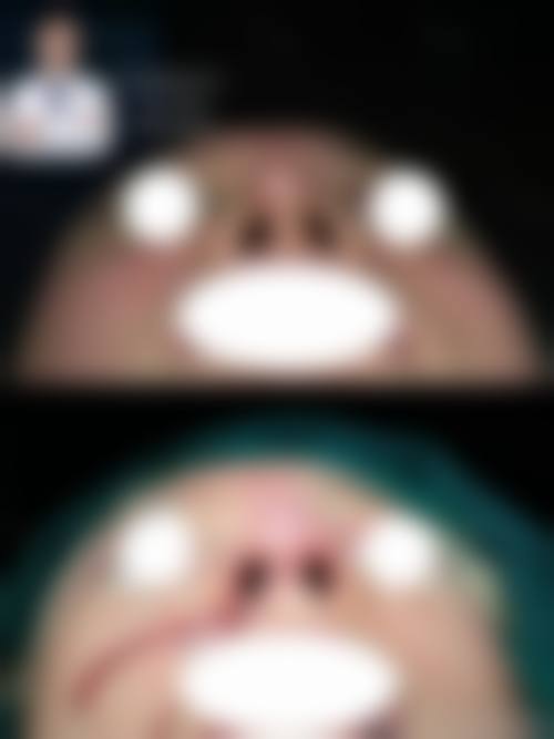 六、秀美颜整形医院收费价格表