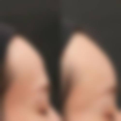 四、重庆奥普恩整形医院特色项目及技术优势