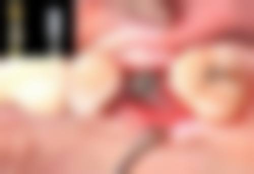 整形项目分类价目表