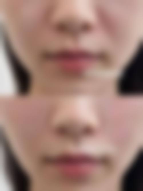 七、肇庆柏悦医疗美容门诊部口碑怎么样？