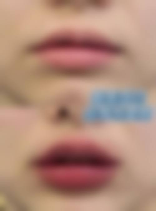 二、深圳南山区人民医院整形美容科是正规医院吗？