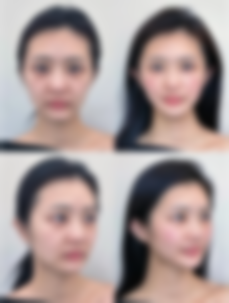 五、烟台宝菲整形医院收费价格表