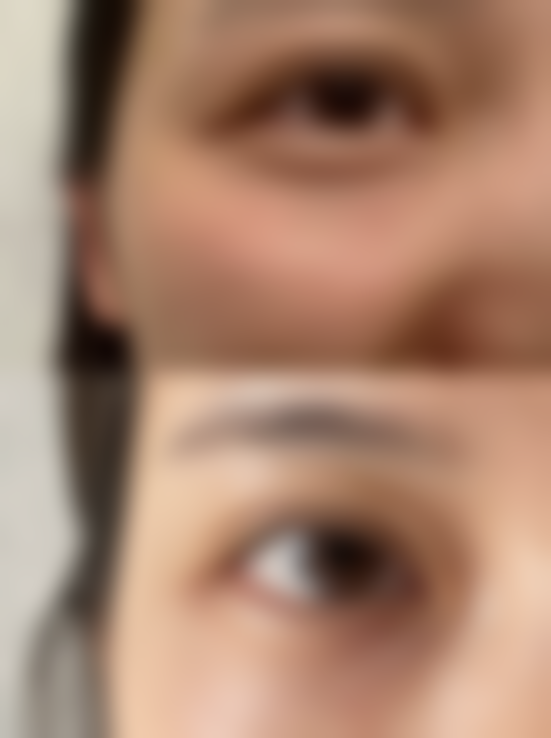 四、洛阳臻颜整形医院特色项目及技术优势