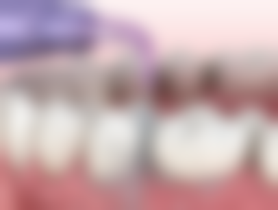 牙缝变大：正确看待变化，做好后续护理