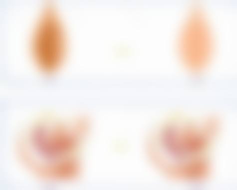 八、南宁梦想医疗美容整形门诊部预约挂号方式及流程