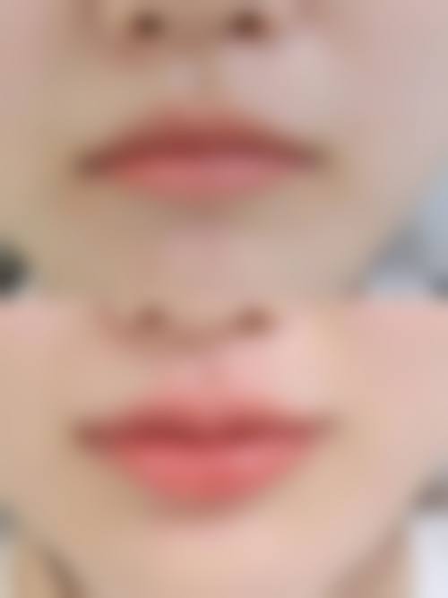 六、武汉伊丽莎白整形医院收费价格表