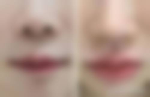 六、成都睿麟医疗美容诊所收费价格表