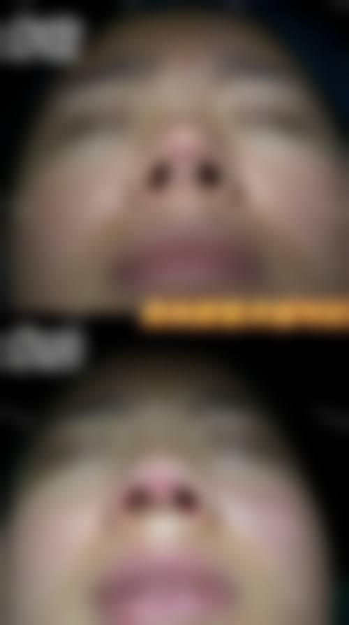 七、南宁千寻医学美肤连锁（航洋院）口碑怎么样？