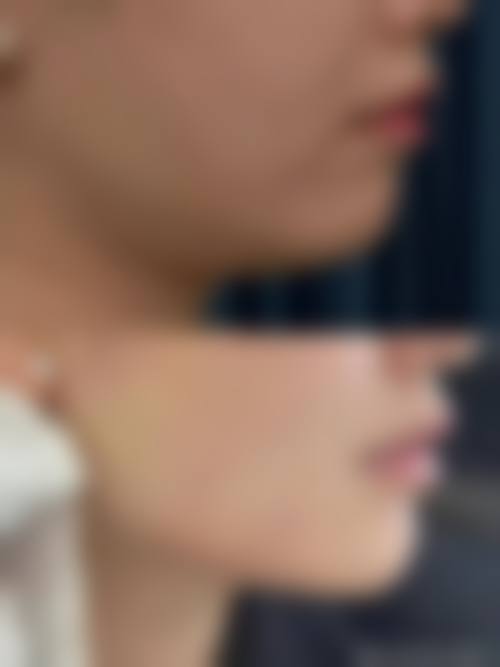 六、庆阳华美医疗美容诊所收费价格表