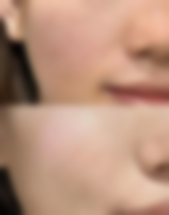 六、杭州丽颜辰医疗美容口碑怎么样？