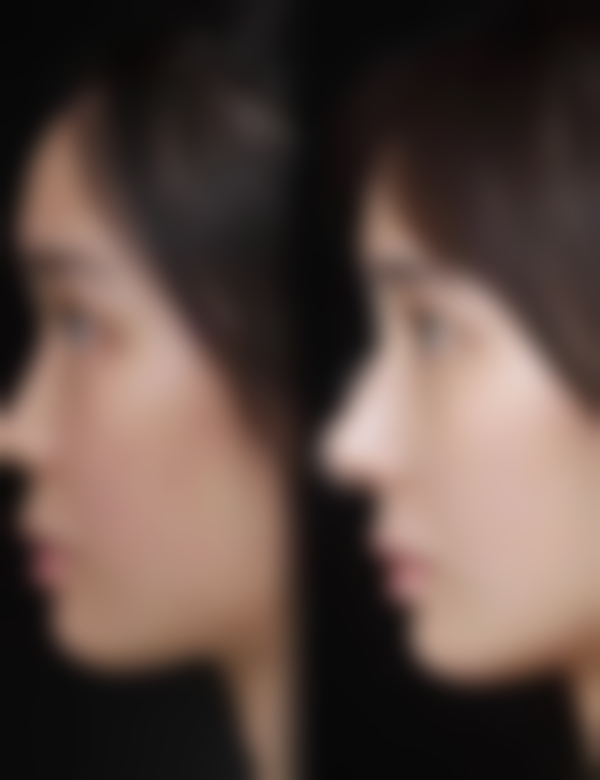 七、无锡曼丽莎禾丽医疗美容医门诊部预约挂号方式及流程