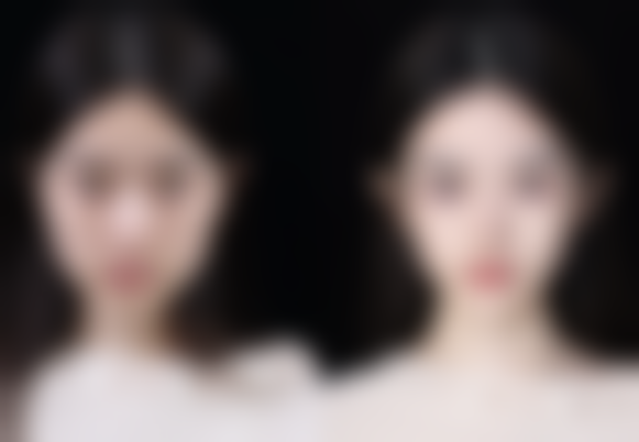 六、香港恒時整形医院口碑怎么样?