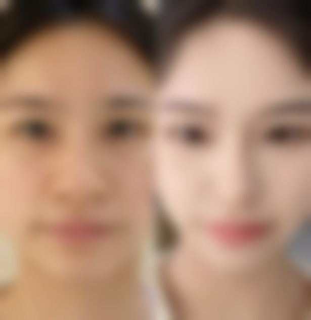 五、香港恒時整形医院收费价格表