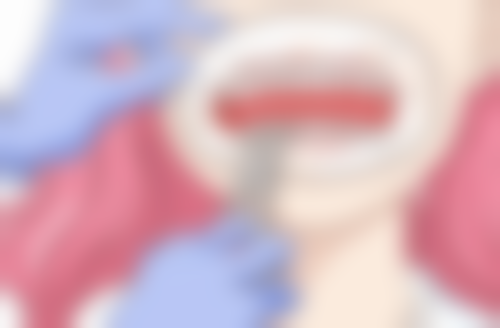 治疗不完全：根管治疗疼痛的潜在隐患