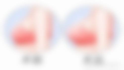 六、日本宇都宫竹内美容外科医院收费价格表