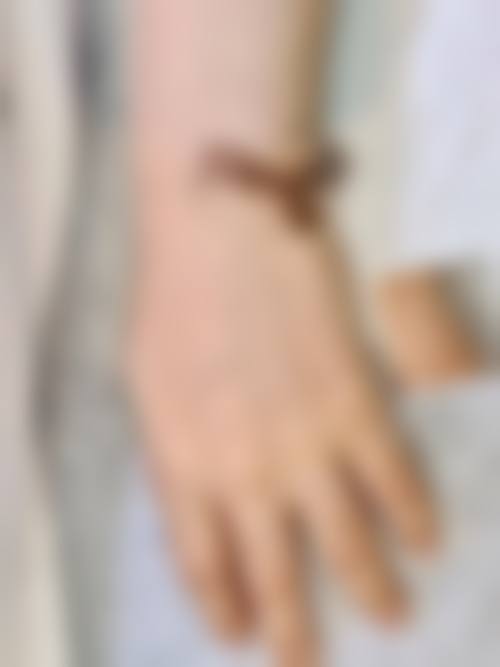 二、汕头星小雅整形医院是正规医院吗?