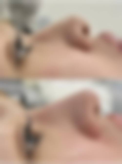 张晓飞医生预约挂号