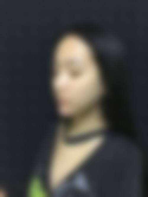 张晓飞医生擅长项目