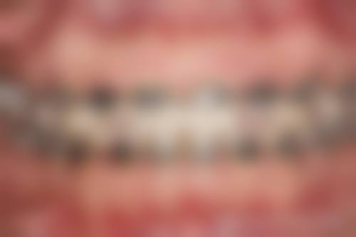 合肥贝杰口腔就诊指南