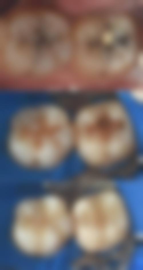 热门项目价格深度拆解