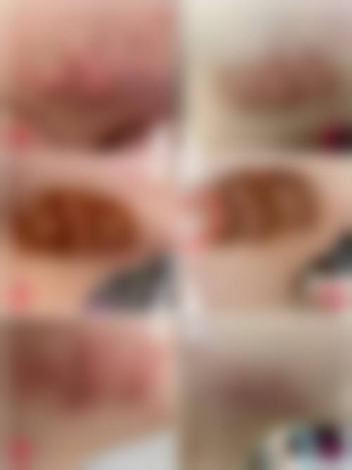 四、商丘维多利亚医疗美容门诊部收费价格表