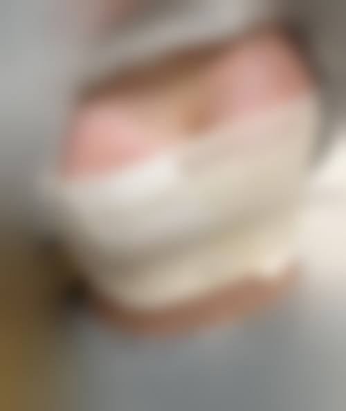 二、深圳雅美医疗美容诊所是正规医院吗？