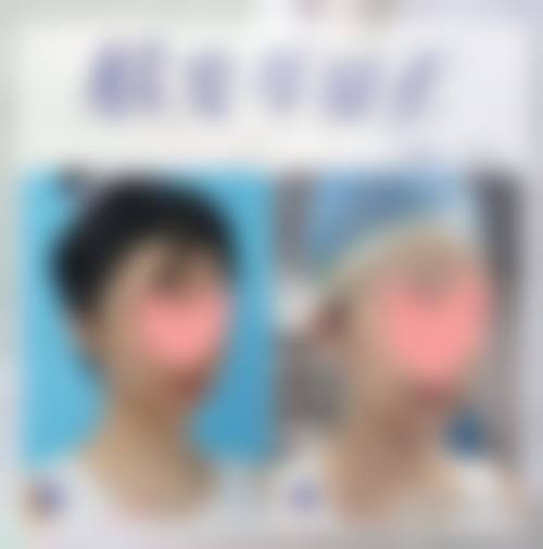 二、重庆圣熙整形医院是正规医院吗