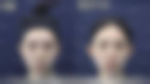 七、韩国迪美丽整形外科口碑怎么样？