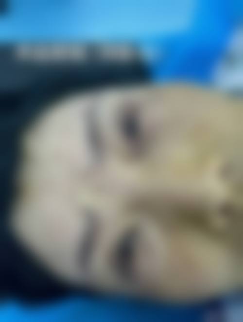 六、重庆圣熙整形医院口碑怎么样