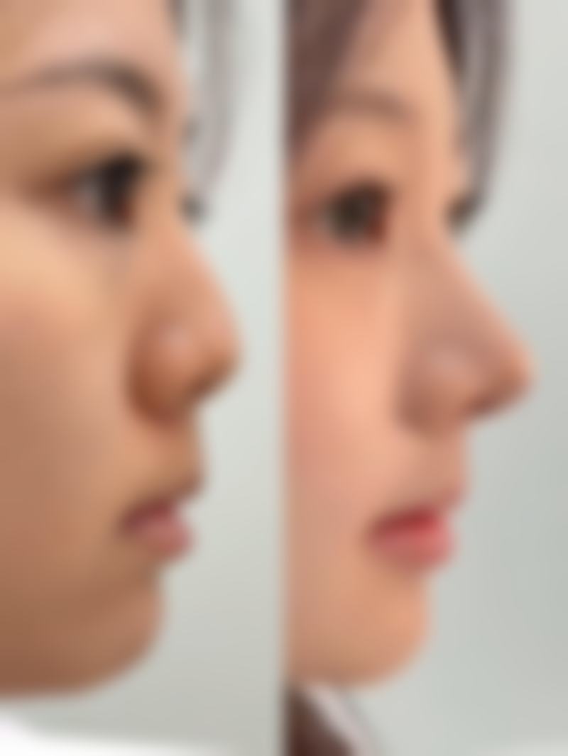 四、重庆圣熙整形医院特色项目及技术优势