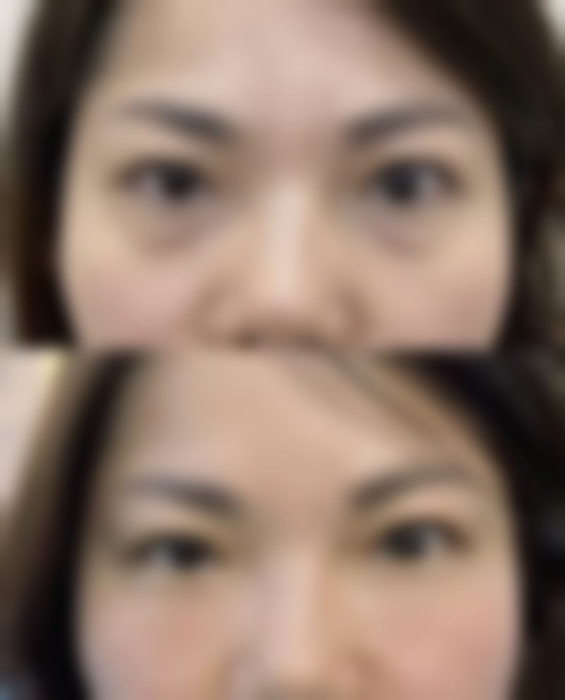 陈怡皆医生技术优势