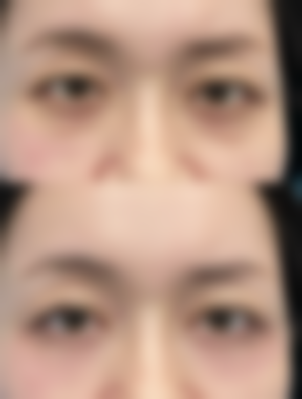 六、深圳雅美医疗美容诊所口碑怎么样？