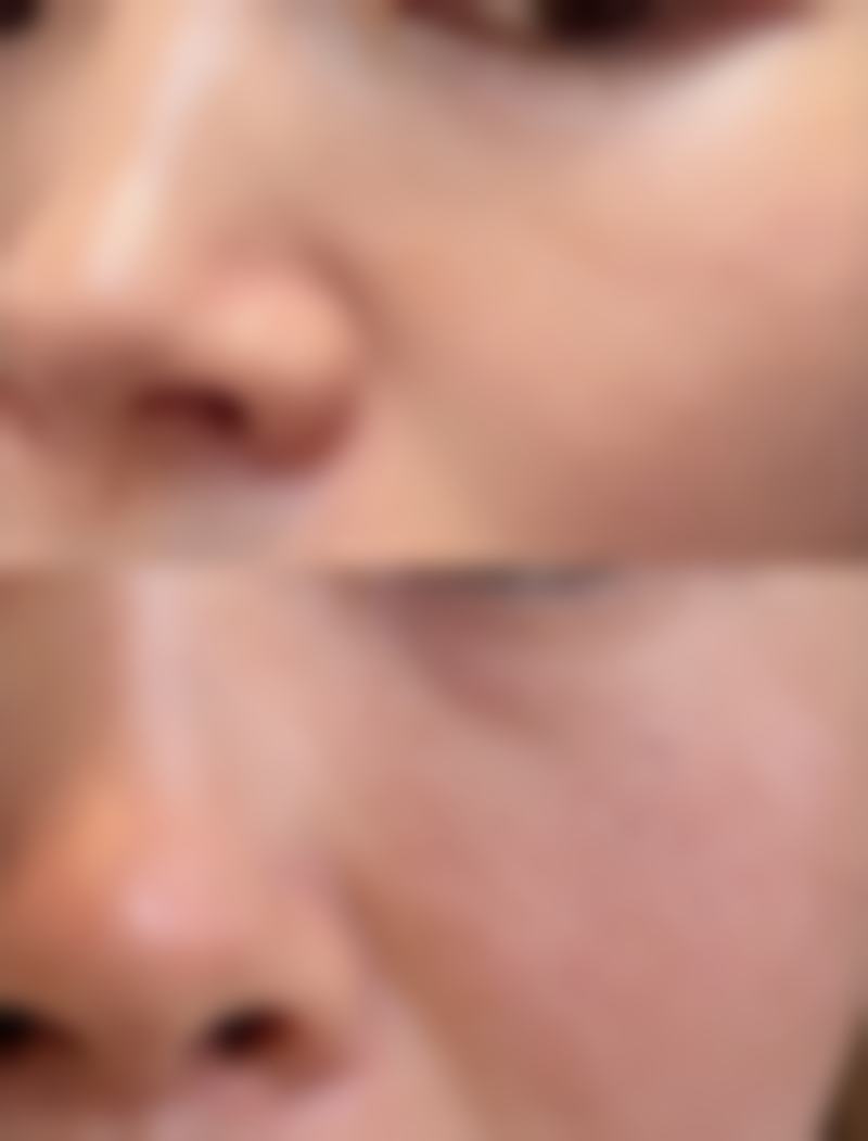 黄锋医生擅长项目