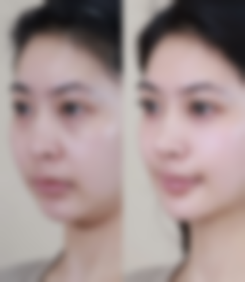 马越医生擅长项目