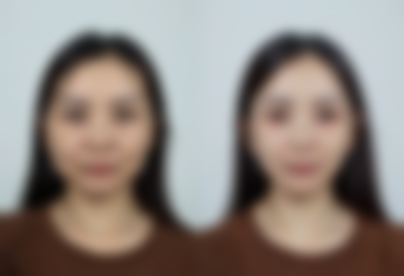 银丽医生技术优势