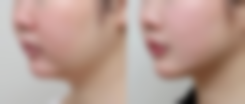 三、韩国迪美丽整形外科地址电话营业时间