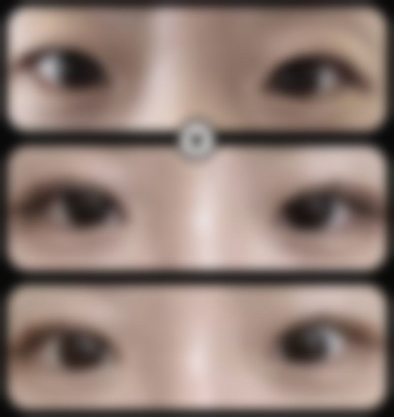 五、汕头星小雅整形医院收费价格表