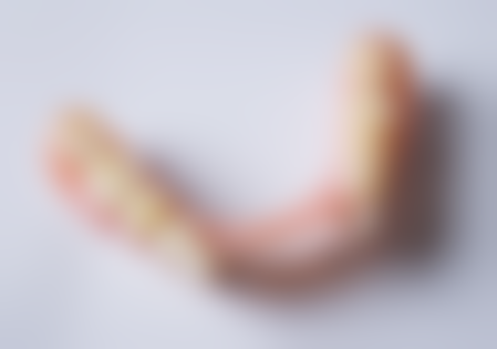 全瓷牙：美观与健康并存