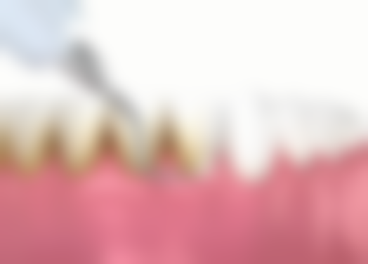 各医院隐形矫正优势