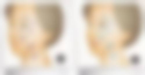 李朋医生口碑评价