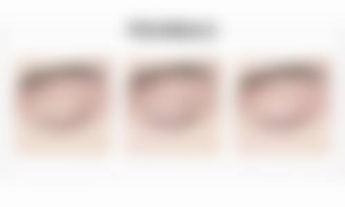 七、郑州艺美千嘉延丽美容整形医院口碑怎么样