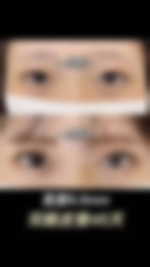 三、韩国德汉斯整形医院地址电话营业时间