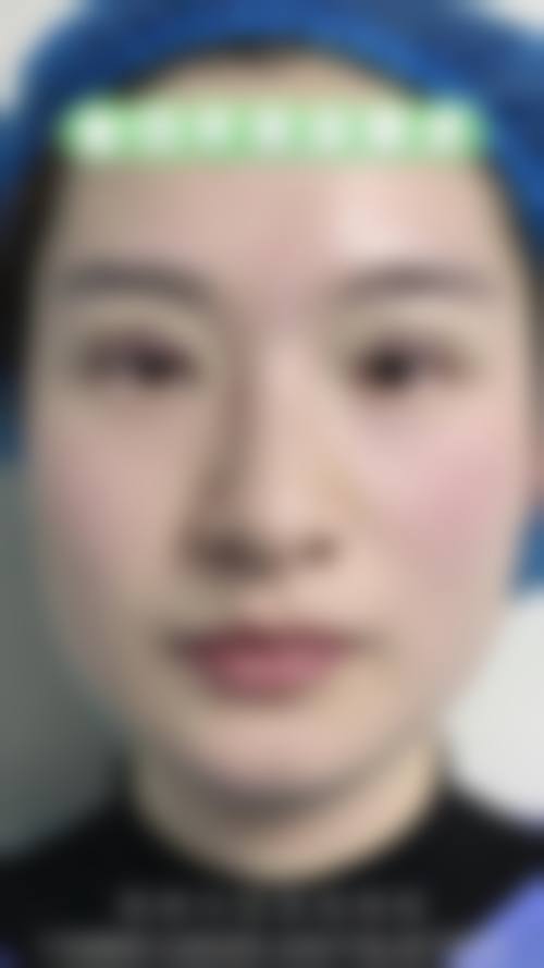 七、深圳非凡医疗整形美容医院口碑怎么样？