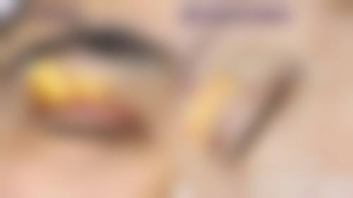 扈明轩医生口碑评价