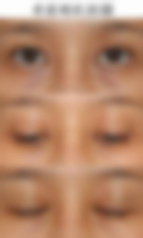 四、深圳非凡医疗整形美容医院特色项目及技术优势