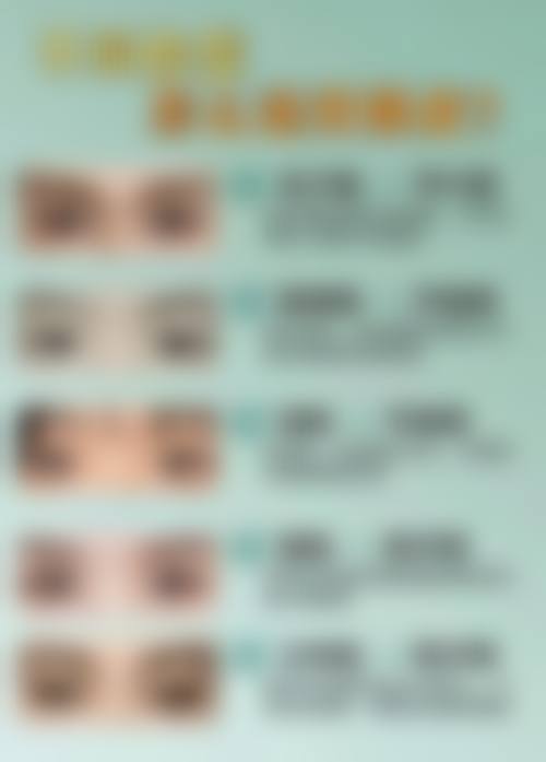 二、深圳非凡医疗整形美容医院是正规医院吗？