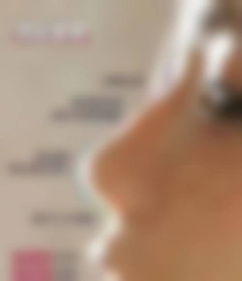 七、济宁华悦整形医院口碑怎么样？