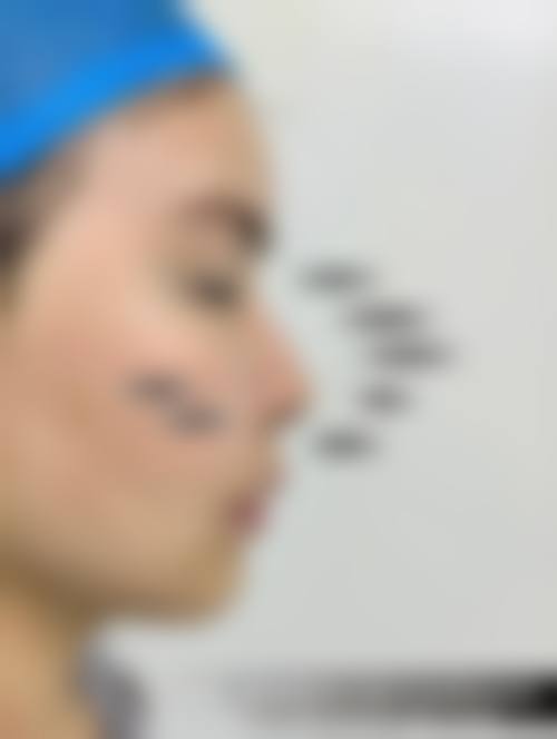 李洪山医生口碑评价