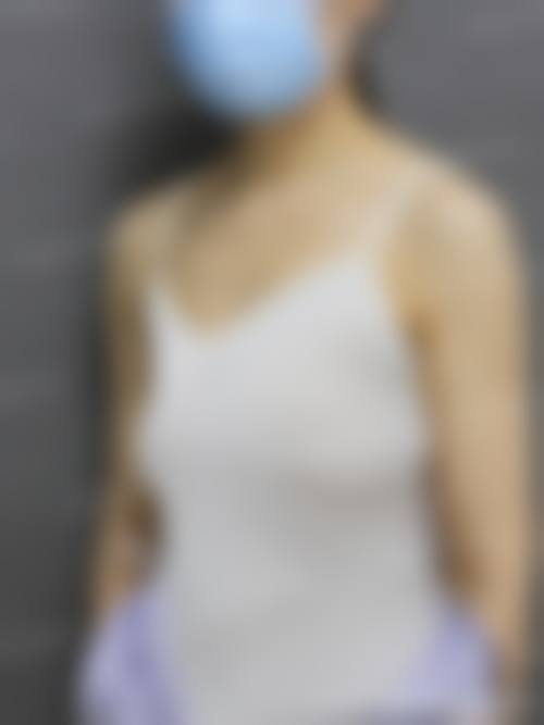 四、济宁华悦整形医院特色项目及技术优势