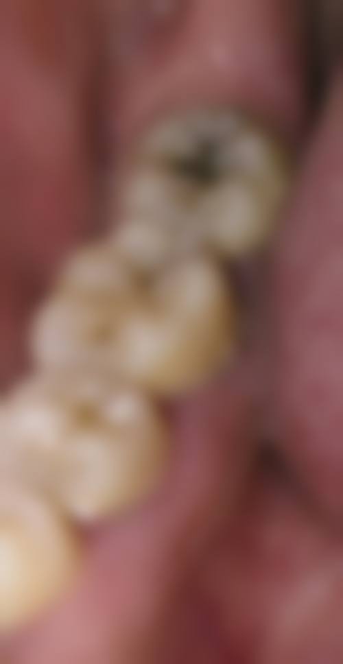 义齿询问的优势与意义